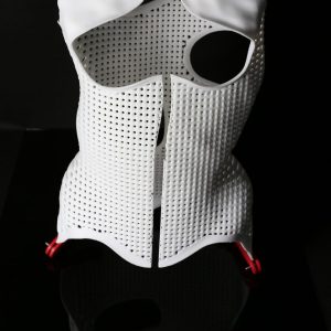 3D Printed Spinal Brace